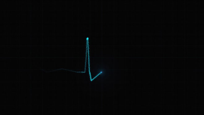 Loopable Electrocardiogram: Stock Motion Graphics